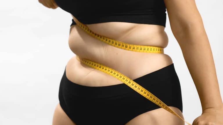 أعراض السمنة ومضاعفاتها وطرق الوقاية منها أعراض السمنة ومضاعفاتها وطرق الوقاية منها